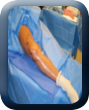Visual Sclerotherapy
